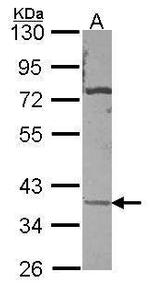 Carbonic Anhydrase XI Polyclonal Antibody