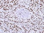 hnRNP F Antibody in Immunohistochemistry (Paraffin) (IHC (P))