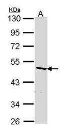 hnRNP F Antibody in Western Blot (WB)