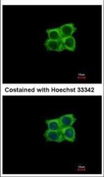 LAD1 Polyclonal Antibody