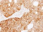 LAD1 Antibody in Immunohistochemistry (Paraffin) (IHC (P))