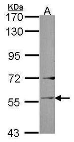 LAD1 Antibody in Western Blot (WB)