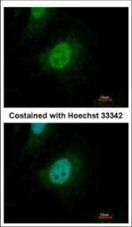 SMAD9 Polyclonal Antibody