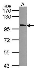 MYO1B Polyclonal Antibody