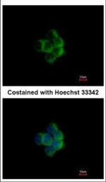 NDUFA10 Polyclonal Antibody