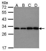 PGAM1 Polyclonal Antibody