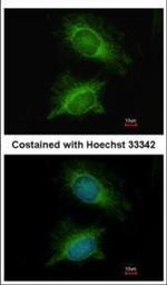 PGM3 Polyclonal Antibody