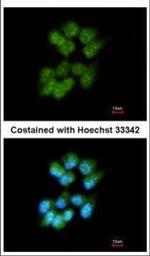 SLA Polyclonal Antibody