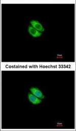 Syntrophin alpha-1 Polyclonal Antibody