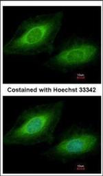 TSSC1 Polyclonal Antibody