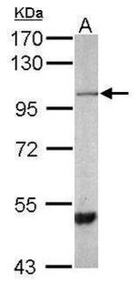 SPG7 Antibody in Western Blot (WB)