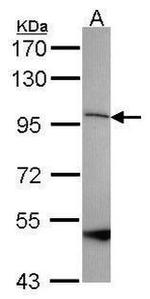 SPG7 Antibody in Western Blot (WB)