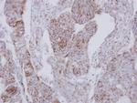 NDUFS2 Polyclonal Antibody