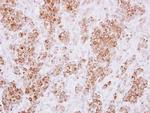HLA-DMA Polyclonal Antibody