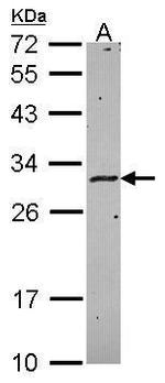 HLA-DMA Antibody in Western Blot (WB)