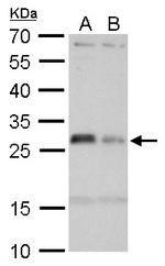 HLA-DMA Antibody in Western Blot (WB)