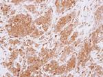 RGS10 Polyclonal Antibody