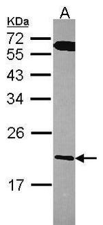 RGS10 Antibody in Western Blot (WB)