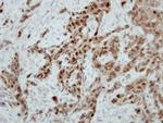Ataxin 3 Polyclonal Antibody