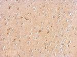 Chromogranin C Antibody in Immunohistochemistry (Paraffin) (IHC (P))