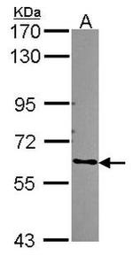 ARHGEF5 Antibody in Western Blot (WB)