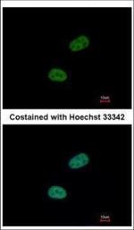 SRPX Polyclonal Antibody
