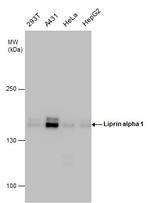 PPFIA1 Antibody in Western Blot (WB)