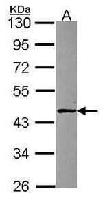 ABH1 Polyclonal Antibody