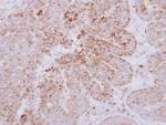 GYG2 Polyclonal Antibody