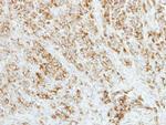 AP4M1 Antibody in Immunohistochemistry (Paraffin) (IHC (P))