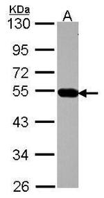 AP4M1 Antibody in Western Blot (WB)