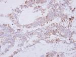 GRAP2 Polyclonal Antibody
