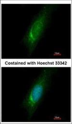 HOMER3 Antibody in Immunocytochemistry (ICC/IF)