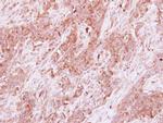 HOMER3 Antibody in Immunohistochemistry (Paraffin) (IHC (P))