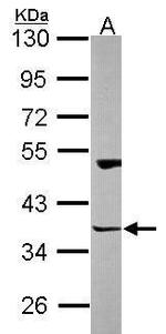 HOMER3 Antibody in Western Blot (WB)