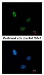 HEAB Polyclonal Antibody