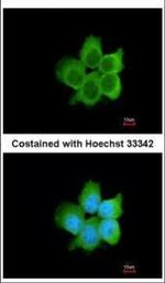 Calcyclin Polyclonal Antibody