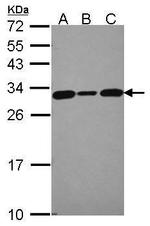 Calcyclin Antibody in Western Blot (WB)