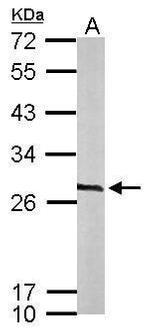 Calcyclin Antibody in Western Blot (WB)