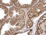 H-Ras Antibody in Immunohistochemistry (Paraffin) (IHC (P))