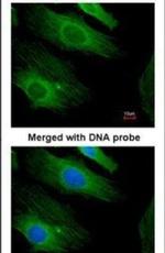 H-Ras Antibody in Immunocytochemistry (ICC/IF)