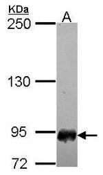 SFMBT1 Polyclonal Antibody