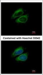CSDE1 Polyclonal Antibody