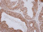 PNPase Polyclonal Antibody