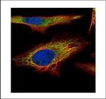 PNPase Polyclonal Antibody