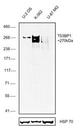 53BP1 Polyclonal Antibody, DyLight™ 650