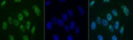 53BP1 Antibody in Immunocytochemistry (ICC/IF)