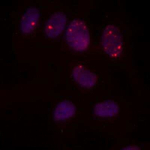 53BP1 Antibody in Immunocytochemistry (ICC/IF)