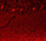 NOTCH3 Polyclonal Antibody