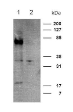 CRTH2 Polyclonal Antibody